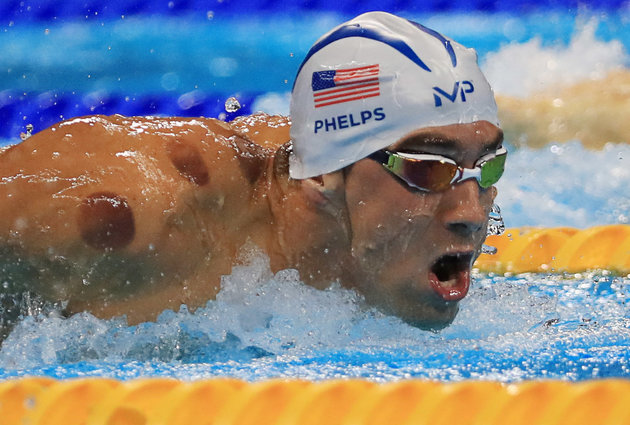 2016 Rio Olympics - Swimming - Preliminary - Men's 200m Butterfly - Heats - Olympic Aquatics Stadium - Rio de Janeiro, Brazil - 08/08/2016. Michael Phelps (USA) of USA is seen with red cupping marks on his shoulder as he competes. REUTERS/Dominic Ebenbichler FOR EDITORIAL USE ONLY. NOT FOR SALE FOR MARKETING OR ADVERTISING CAMPAIGNS.